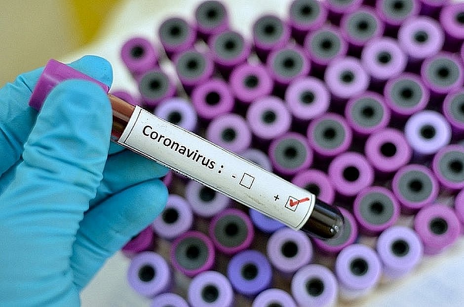 Primeiro caso de mutação mais contagiosa do coronavírus é detectado em Salvador