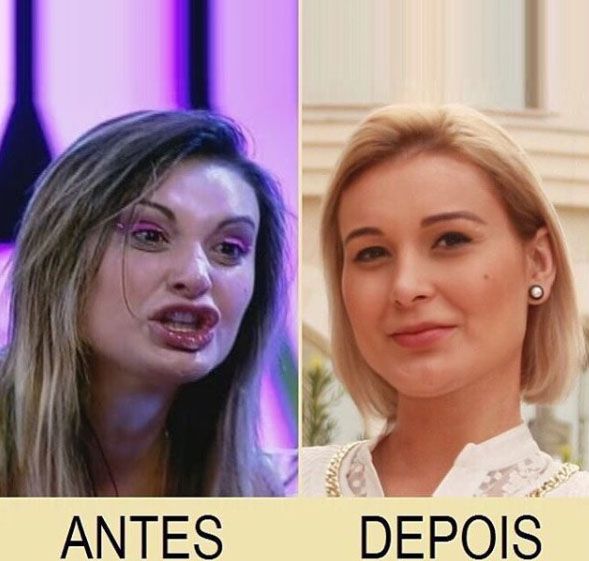 Andressa Urach mostra antes e depois e celebra 'Obrigada Jesus